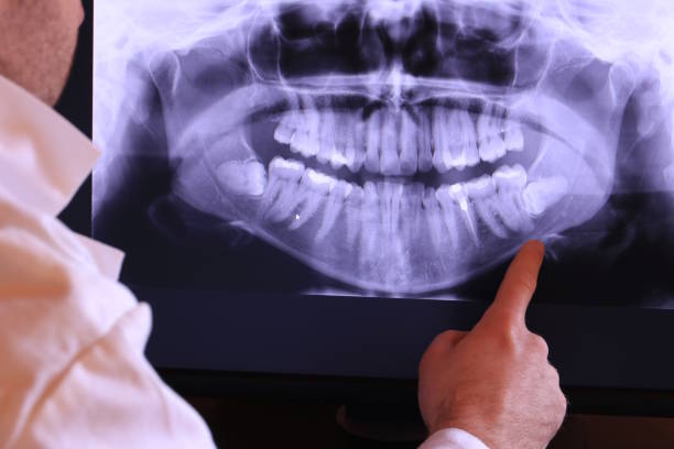 Best Knocked-Out Tooth Emergency  in Rockville, CT