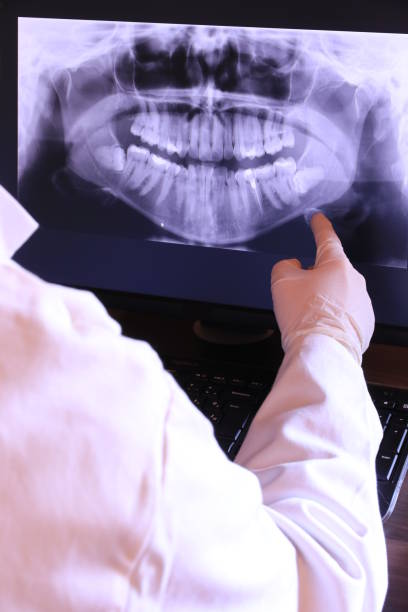 Best Root Canal Emergency Dentist  in Rockville, CT